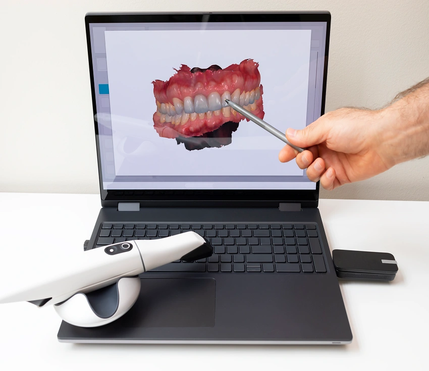 Digital Smile Design